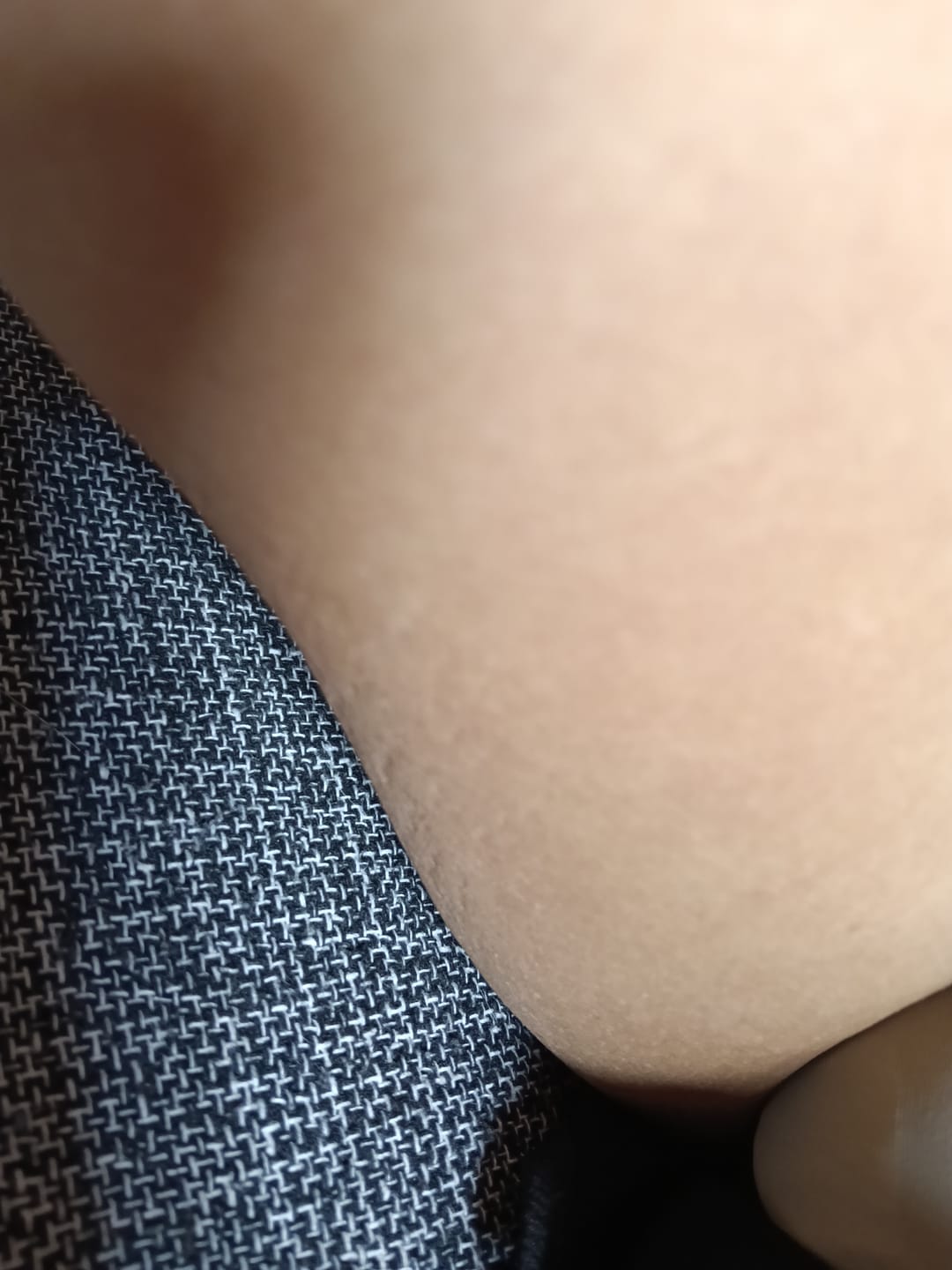 Customer photo review of Creme Clareador de Manchas – Melasma, Axilas, Virilha, Áreas Íntimas, Rosto e Corpo