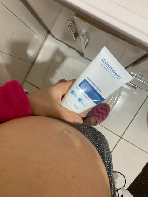 Customer photo review of Creme Antiestrias Regenerador Dérmico