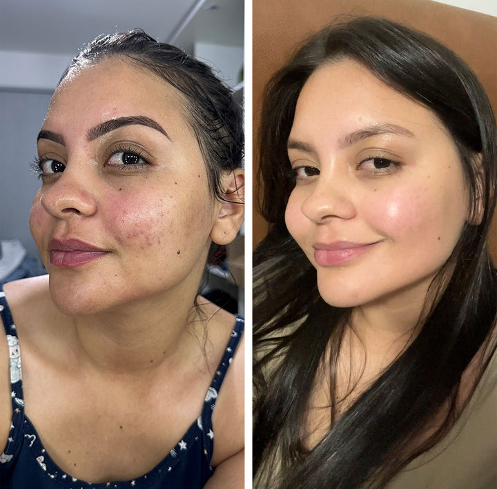 Antes e depois